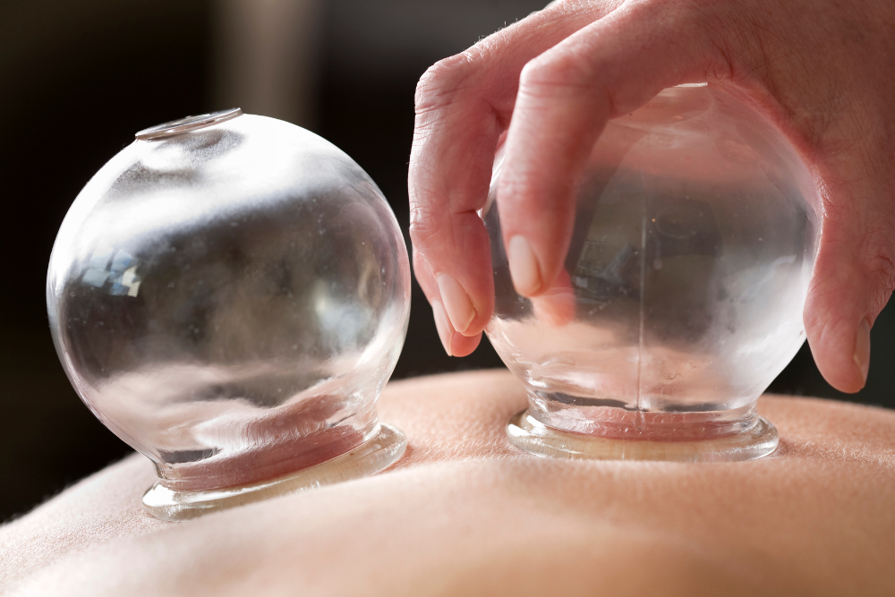 cupping therapy indianapolis